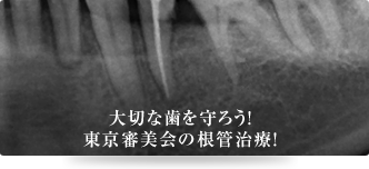 大切な歯を守ろう！東京審美会の根管治療！